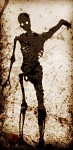 Necrosis