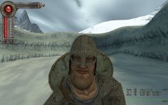 What the fuck is wrong with his eyes?