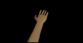 Arm