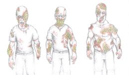 Infected Human