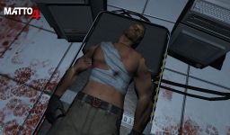 Gunshot Wounds