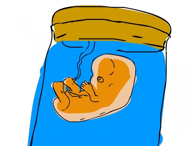 Oliver the Embryo in a jar