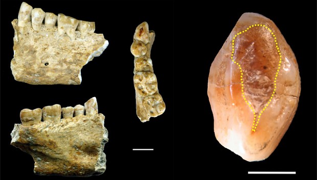 Beeswax discovered as ancient tooth filling