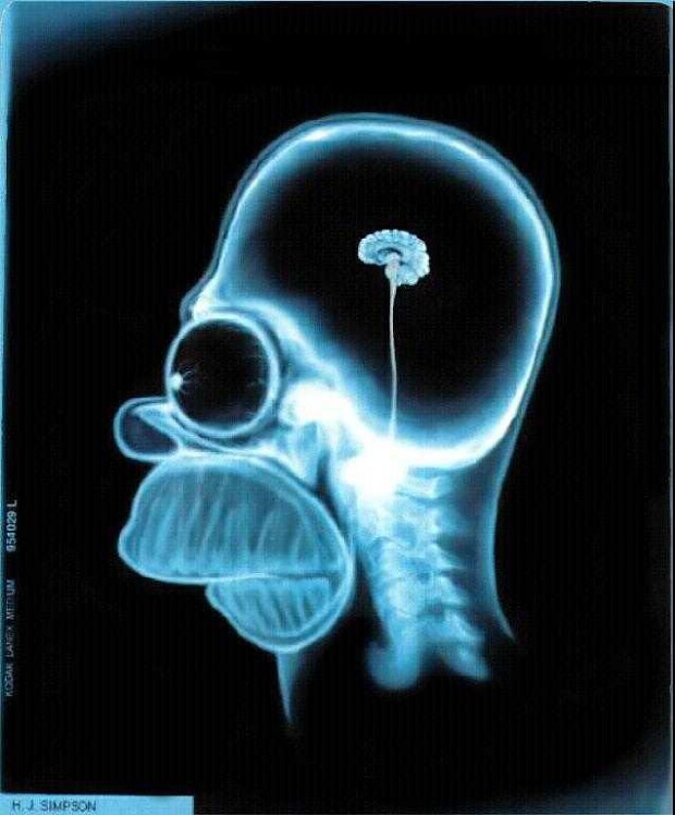 Homers Brain Xray