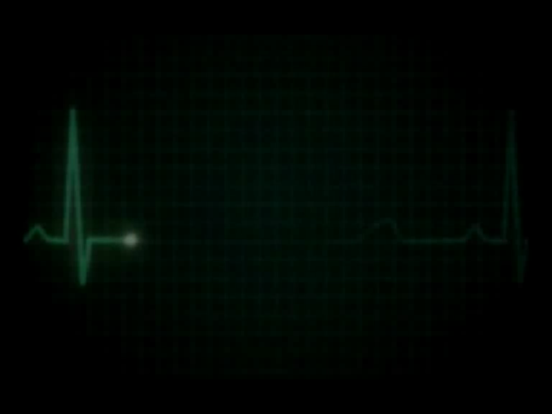 Heartbeat image - This Is Where I Want To Die - Mod DB